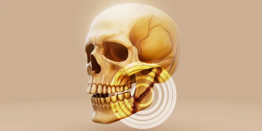 TMJ vs. Other Jaw Problems